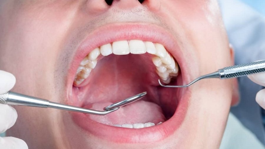 how does diabetes cause oral health problems