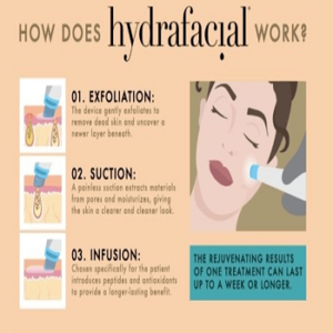 How does the Hydrafacial work