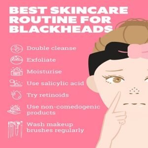How to prevent Blackheads