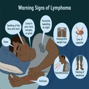 Lymphoma-symptoms-ft-beautyopacity