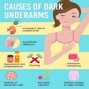 causes of dark underarms